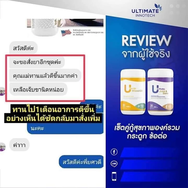 หมอนรองกระดูกทับเส้น กระดูกทับเส้น ปวดหลัง ปวดเอว ปวดสะโพก ปวดร้าวลงขา ขาชา ขาอ่อนแรง